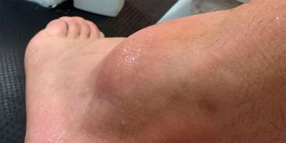 Lesión de Adrián Maravilla Martínez preocupa a Racing Club tras partido