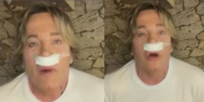 Guido Süller revela detalles de su reciente intervención estética