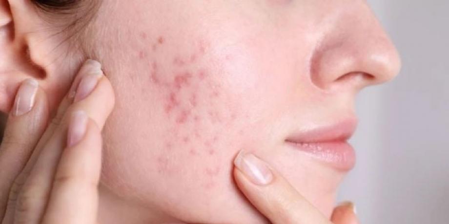 Cortesía de minutoneuquen